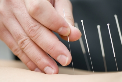 Acupuncture relieves pain in emergency patients