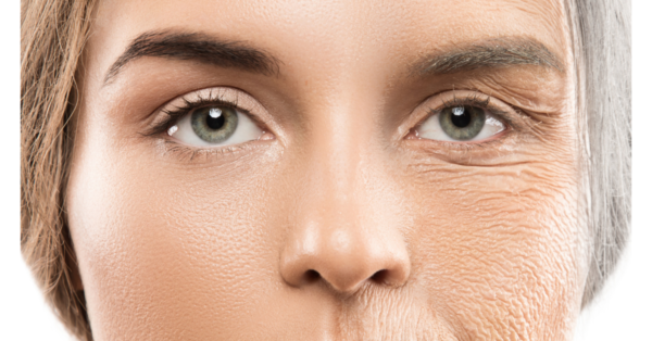 Allergies Aging